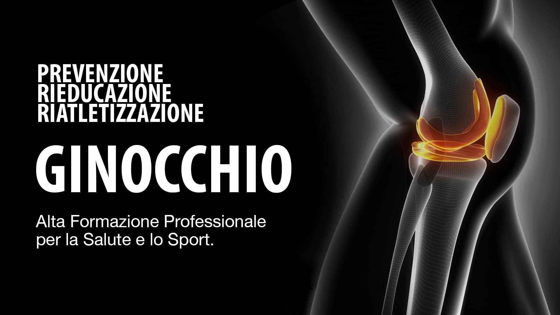 Ginocchio