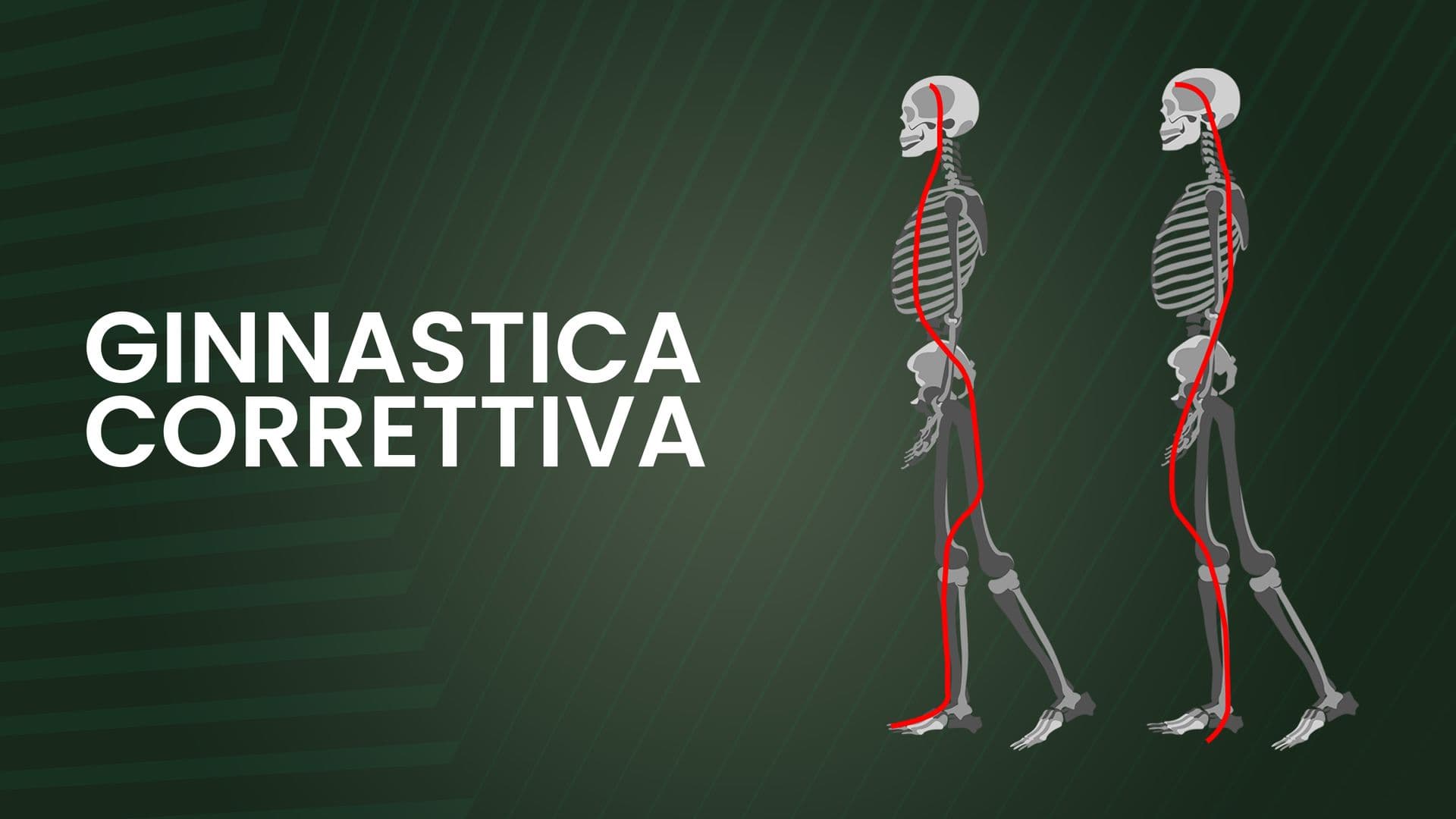 Ginnastica Correttiva